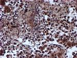 RUVBL2 Antibody in Immunohistochemistry (Paraffin) (IHC (P))