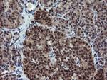 RYBP Antibody in Immunohistochemistry (Paraffin) (IHC (P))