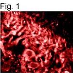 Ryanodine Receptor Antibody in Immunohistochemistry (IHC)