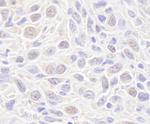 Rad50 Antibody in Immunohistochemistry (IHC)