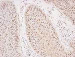 Rad50 Antibody in Immunohistochemistry (IHC)