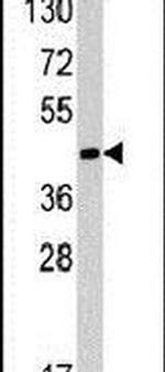 RAD9 Antibody in Western Blot (WB)