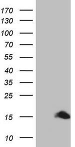 S100A1 Antibody in Western Blot (WB)