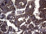 S100A9 Antibody in Immunohistochemistry (Paraffin) (IHC (P))