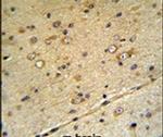 SLC39A3 Antibody in Immunohistochemistry (IHC)