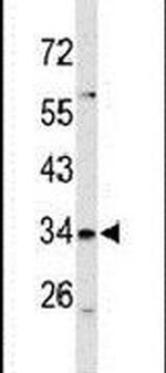 SLC39A3 Antibody in Western Blot (WB)