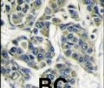 p70 S6 Kinase Antibody in Immunohistochemistry (IHC)