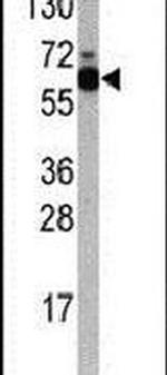 p70 S6 Kinase Antibody in Western Blot (WB)