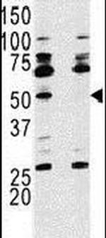 p70 S6 Kinase Antibody in Western Blot (WB)