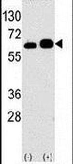 p70 S6 Kinase Antibody in Western Blot (WB)