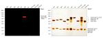 Human IgM Cross-Adsorbed Secondary Antibody in Western Blot (WB)