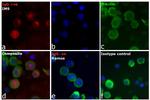 Human IgG (H+L) Cross-Adsorbed Secondary Antibody in Immunocytochemistry (ICC/IF)