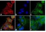 Mouse IgG (H+L) Cross-Adsorbed Secondary Antibody in Immunocytochemistry (ICC/IF)