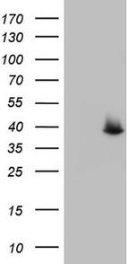 SAE1 Antibody in Western Blot (WB)