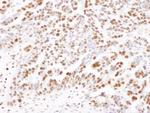 SAMHD1 Antibody in Immunohistochemistry (IHC)