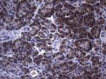 SAMSN1 Antibody in Immunohistochemistry (Paraffin) (IHC (P))