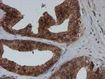 SAT2 Antibody in Immunohistochemistry (Paraffin) (IHC (P))