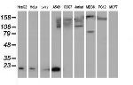 SAT2 Antibody in Western Blot (WB)