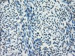 SATB1 Antibody in Immunohistochemistry (Paraffin) (IHC (P))