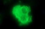 SCAMP2 Antibody in Immunocytochemistry (ICC/IF)