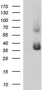 SCAMP2 Antibody in Western Blot (WB)