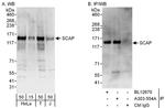 SCAP Antibody in Western Blot (WB)