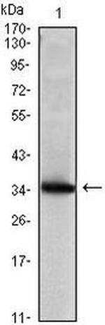 Mammaglobin A Antibody in Western Blot (WB)