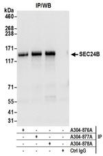 SEC24B Antibody in Immunoprecipitation (IP)