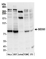 SEC63 Antibody in Western Blot (WB)