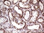 SEMA4D Antibody in Immunohistochemistry (Paraffin) (IHC (P))