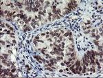 SENP2 Antibody in Immunohistochemistry (Paraffin) (IHC (P))