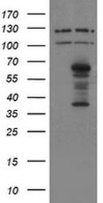 SENP2 Antibody in Western Blot (WB)