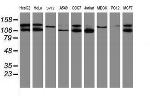 SENP2 Antibody in Western Blot (WB)