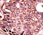 SEPHS2 Antibody in Immunohistochemistry (IHC)