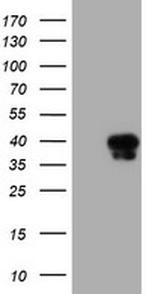 SERPINA5 Antibody in Western Blot (WB)