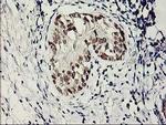 SERPINB13 Antibody in Immunohistochemistry (Paraffin) (IHC (P))