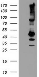 SERPINB13 Antibody in Western Blot (WB)