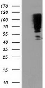 SERPINB13 Antibody in Western Blot (WB)