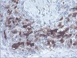 SERPINB2 Antibody in Immunohistochemistry (Paraffin) (IHC (P))