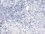 SERPINB2 Antibody in Immunohistochemistry (Paraffin) (IHC (P))