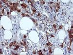 SERPINB2 Antibody in Immunohistochemistry (Paraffin) (IHC (P))