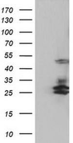SERPINB2 Antibody in Western Blot (WB)