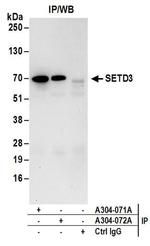 SETD3 Antibody in Western Blot (WB)