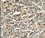 SGF29 Antibody in Immunohistochemistry (IHC)