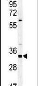 SGF29 Antibody in Western Blot (WB)