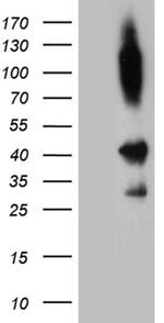 SHARPIN Antibody in Western Blot (WB)