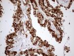 SHMT2 Antibody in Immunohistochemistry (Paraffin) (IHC (P))