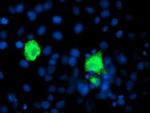 SHPK Antibody in Immunocytochemistry (ICC/IF)