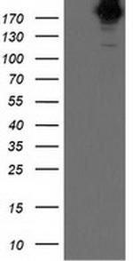 SHPRH Antibody in Western Blot (WB)