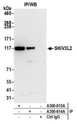 SKIV2L2 Antibody in Western Blot (WB)